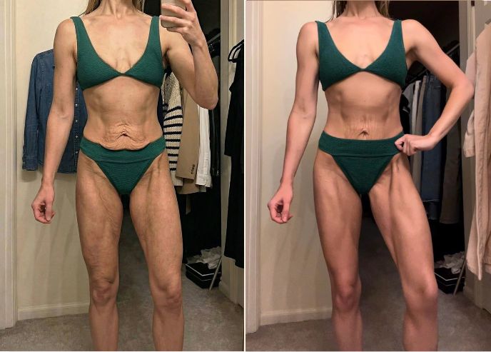 Before and after — Dana M.