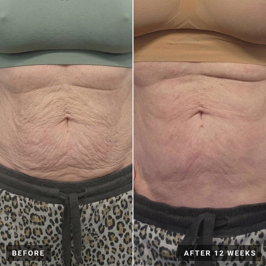 Vesper before and after