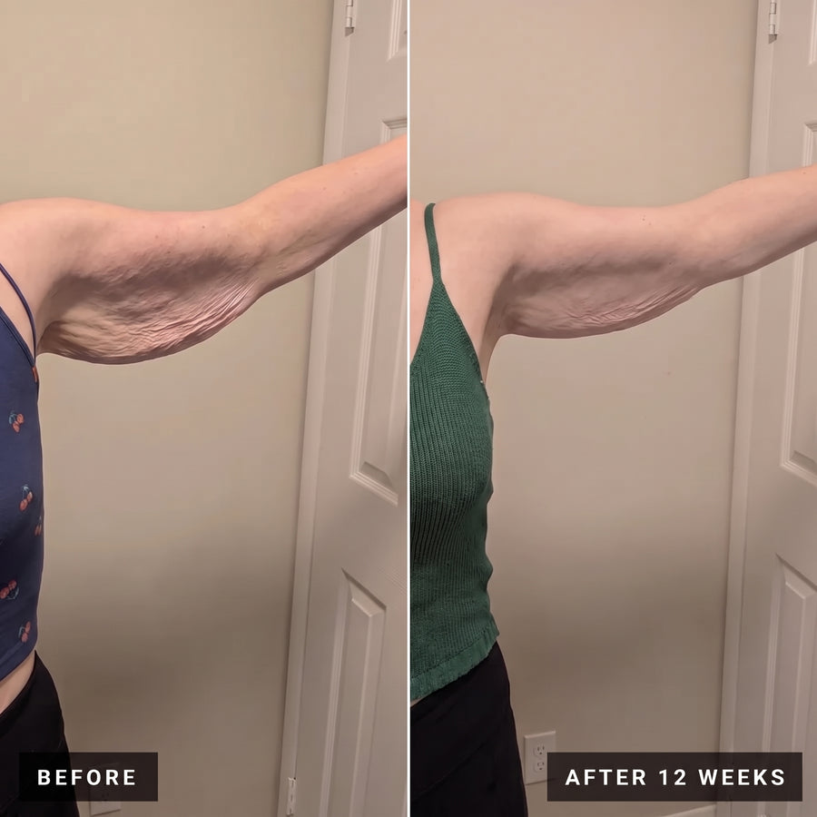 Vesper before and after