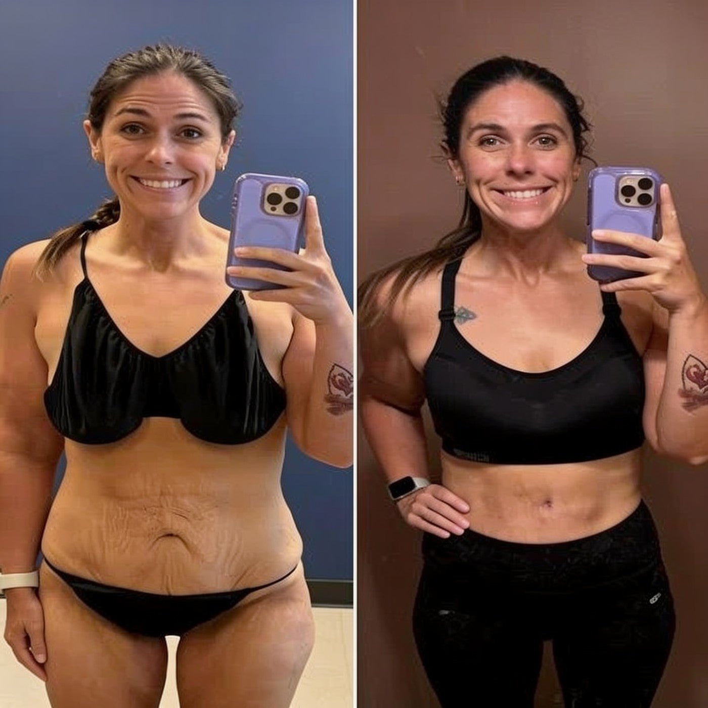 Before and after — Renata