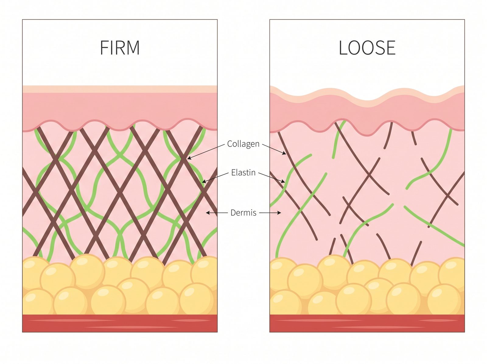 Skin cross-section: firm skin with dense collagen and elastin versus loose skin with collapsed, broken fibers and a sagging surface
